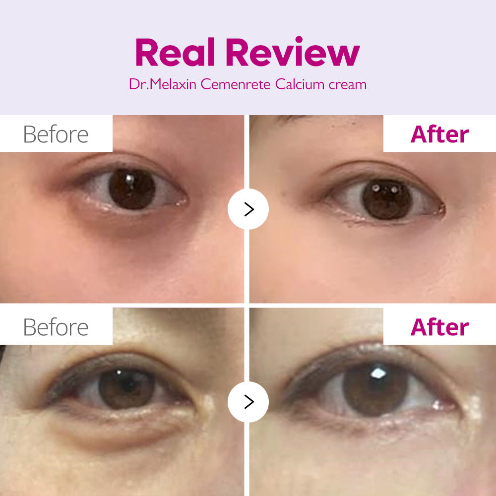 Dr.Melaxin Calcium Dark Spot Eye Cream