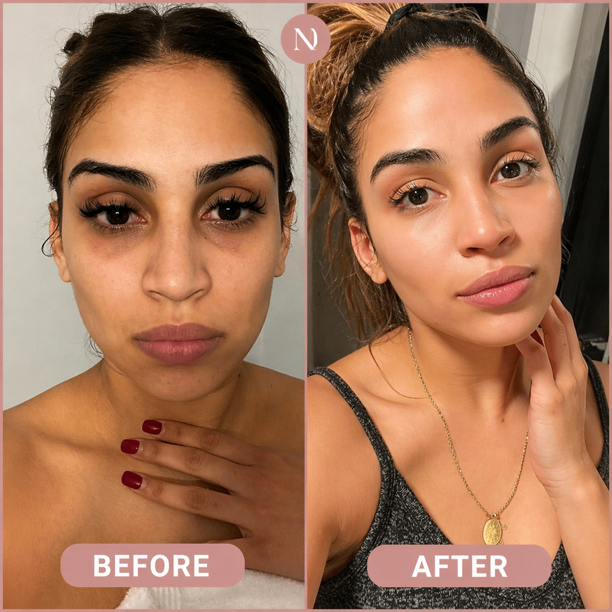 Dr Melaxin Calcium Dark Spot Eye Cream