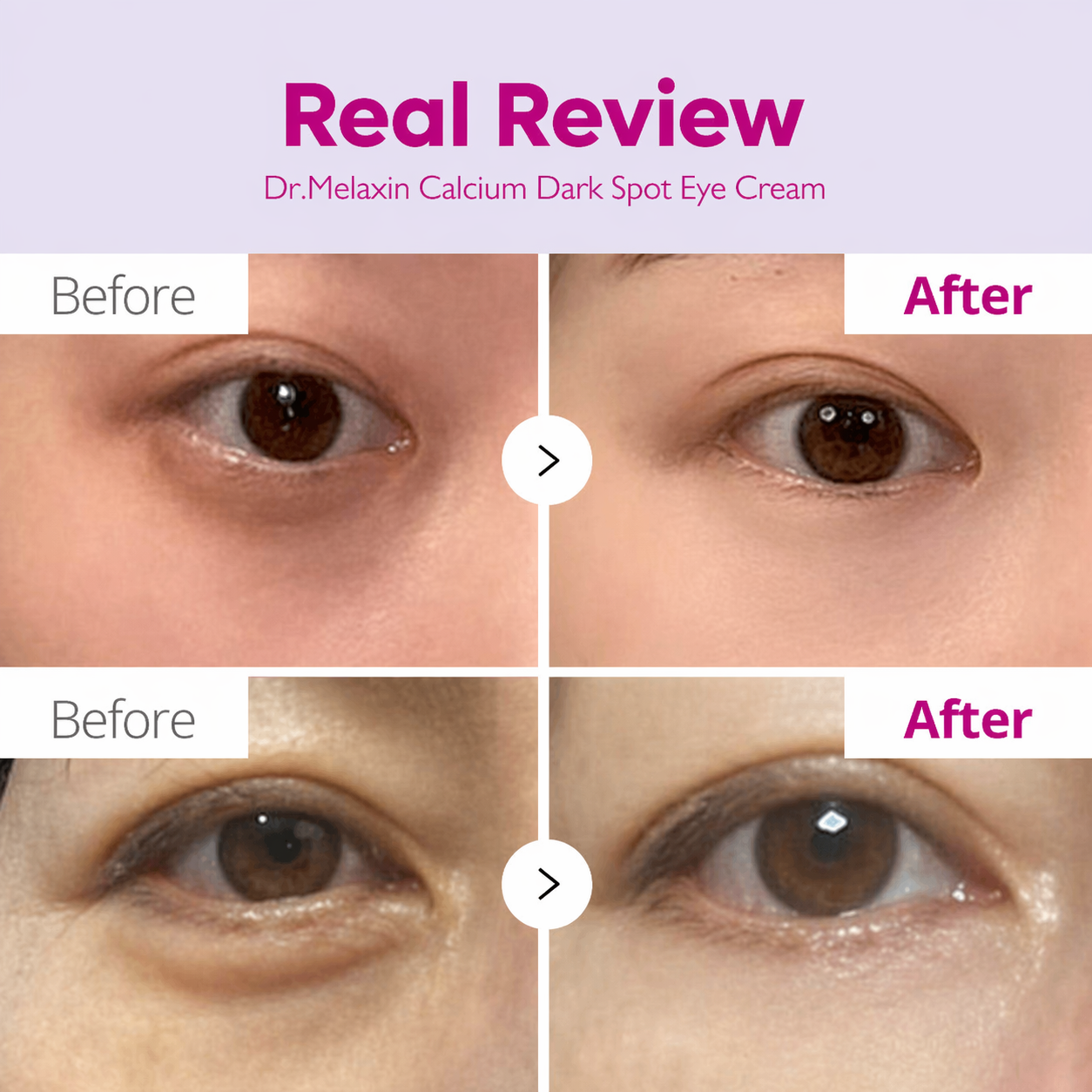 Dr Melaxin Calcium Dark Spot Eye Cream