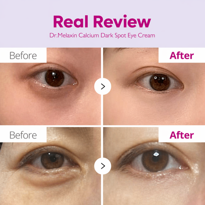 Dr Melaxin Calcium Dark Spot Eye Cream